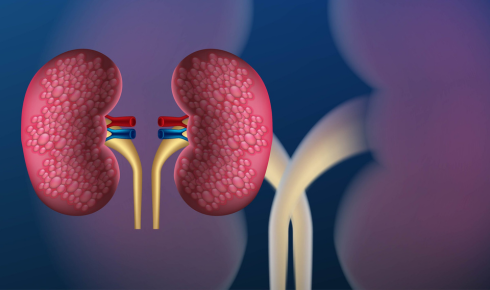 Nephrologist In Bangalore