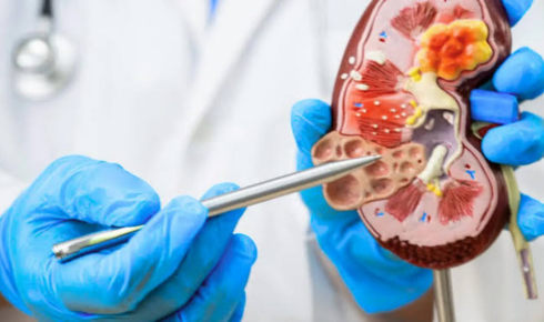 Best Nephrologist In Bangalore