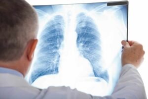 computed radiography
