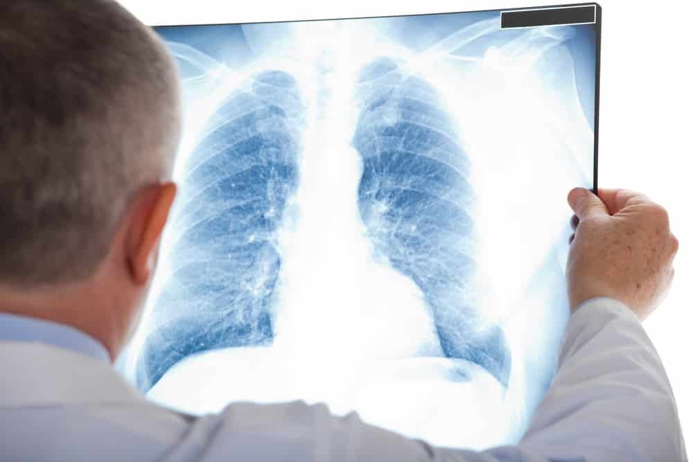 computed radiography